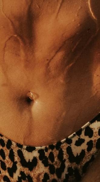 HR Plastic Surgery - Diastasis Recti Surgery At A Glance